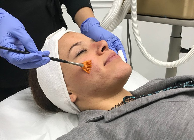 Acne Therapies Training