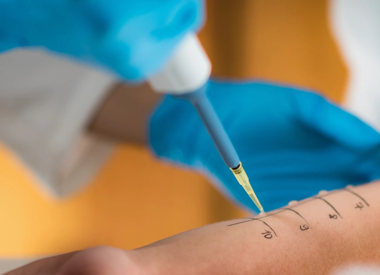 Allergy testing and treatment training workshop