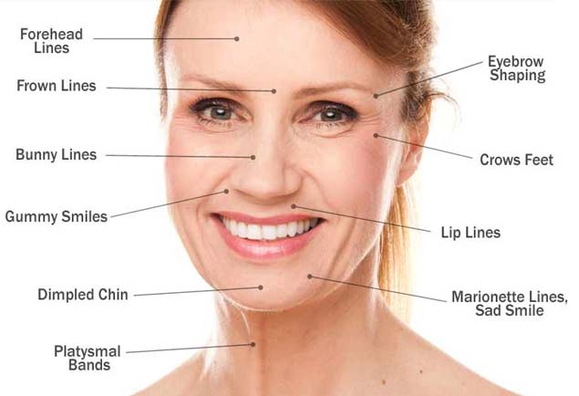 Facial Areas for Botox Injections