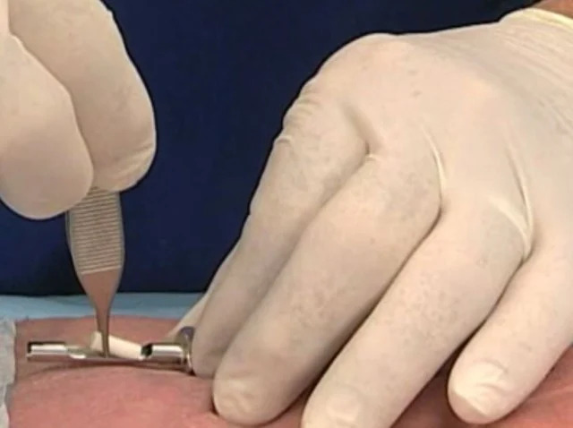 Hormone Pellet Insertion Technique