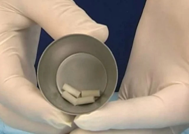 Testosterone Pellets for Hormone Therapy