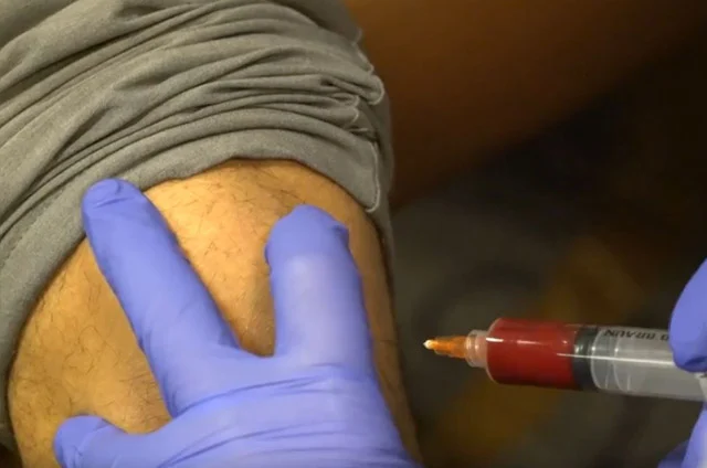 Lateral Knee Injection with Biologics