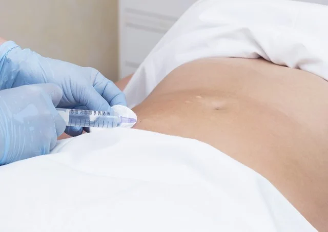 Abdomen adipose fat injection during Mesotherapy Hands-on Training