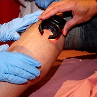 Sclerotherapy Training