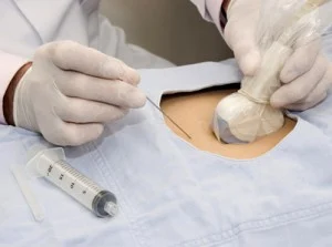 Demonstration of neural block technique utilizing ultrasound
