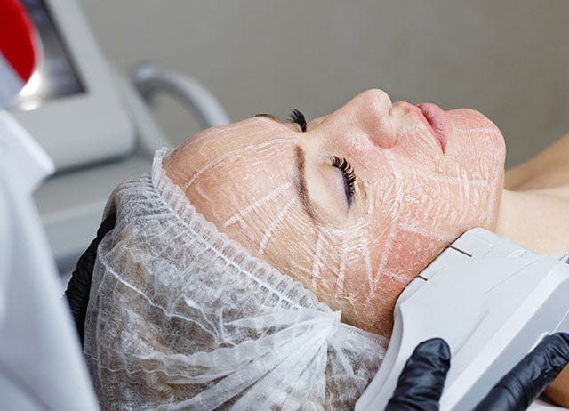 Fractional ER-Yag Laser Procedure of the face during Workshop Training